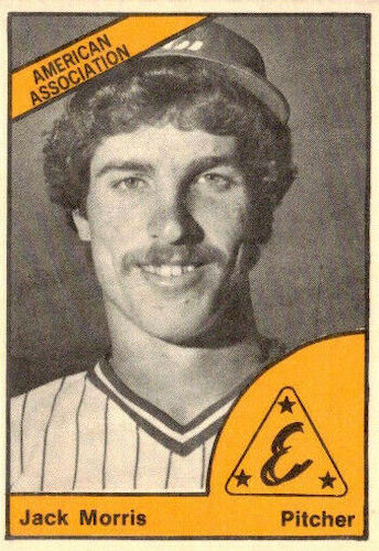 1977 Topps Baseball Cards – 10 Most Valuable – Wax Pack Gods